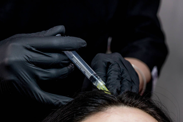 Needle mesotherapy. cosmetologist makes injections in woman head. strengthen the hair and their growth. - Foto, afbeelding