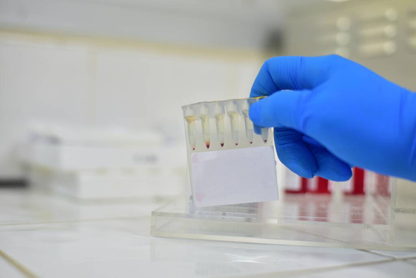 Aglutinación de colúmina de gel en análisis de laboratorio del banco de sangre. - Foto, Imagen