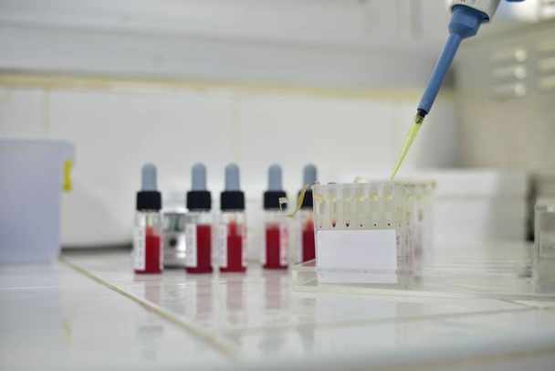 Aglutinação de colume de gel em testes laboratoriais de banco de sangue. - Foto, Imagem