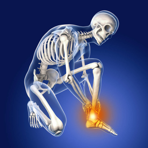 Láb- és bokafájdalom, fogalmi 3D illusztráció. Emberi anatómia - Fotó, kép