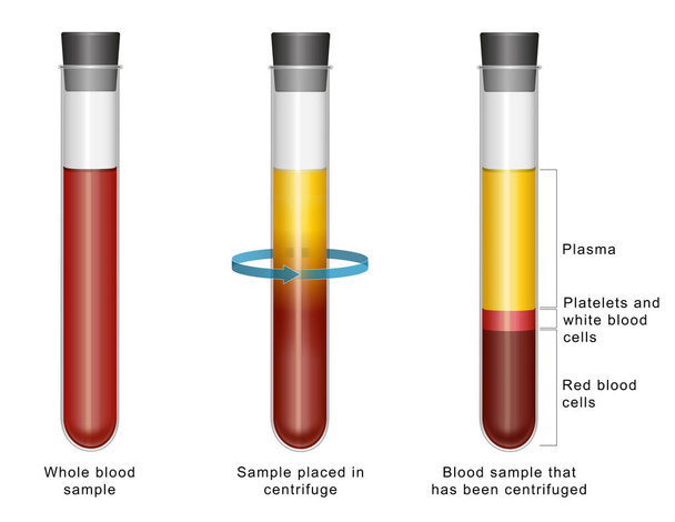 Diagrama que muestra la composición de la sangre - Foto, Imagen