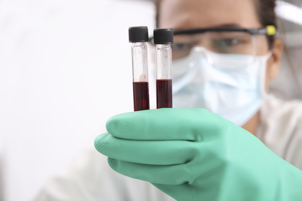 Closeup of a blurred female scientist looking at blood  in test  - Foto, Imagem