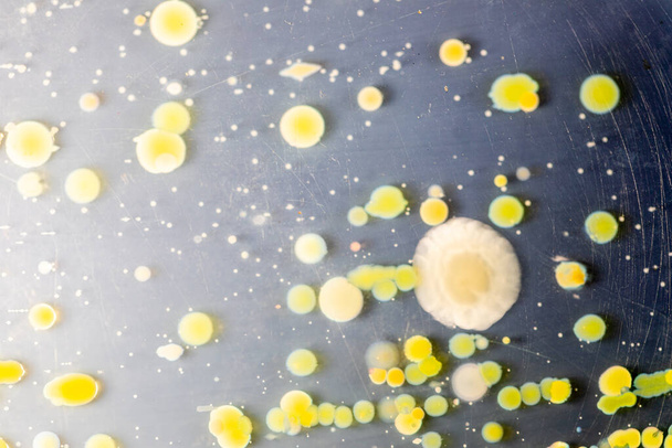 微生物学研究室での教育のための土壌試料からの寒天プレート上に成長する細菌とカビの異なる形のコロニーの特徴と背景. - 写真・画像
