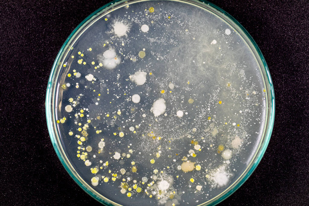 Özellikler ve Farklı şekilli Bakteri ve Küf Kolonisi mikrobiyoloji laboratuarındaki eğitim için toprak örneklerinden tarım plakalarında büyüyor.. - Fotoğraf, Görsel