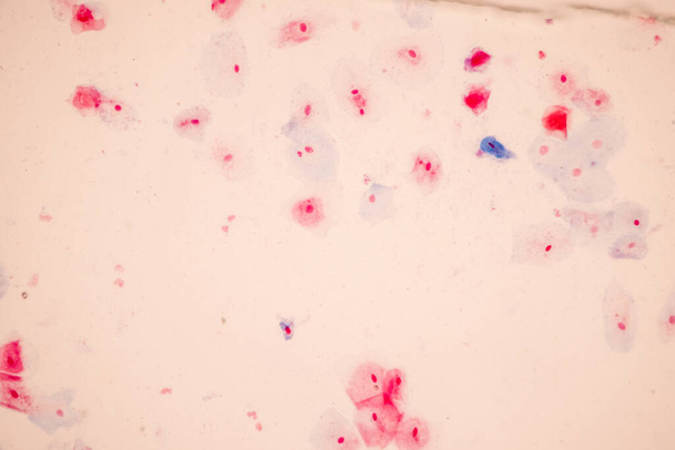 Histologisch monster Plaveiselcelepitheelcellen onder microscoop, - Foto, afbeelding