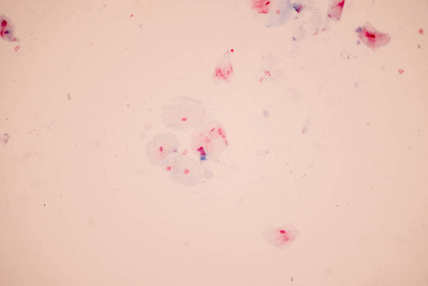 Histologisch monster Plaveiselcelepitheelcellen onder microscoop, - Foto, afbeelding