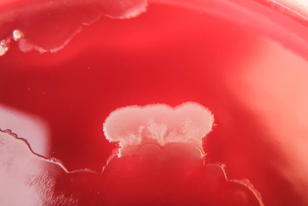 Agar medyada büyüyen bakteri kolonilerinin yakın plan fotoğrafı - Fotoğraf, Görsel