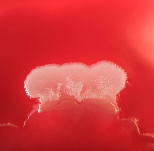 close-up foto van bacteriële kolonies geteeld op agar media - Foto, afbeelding