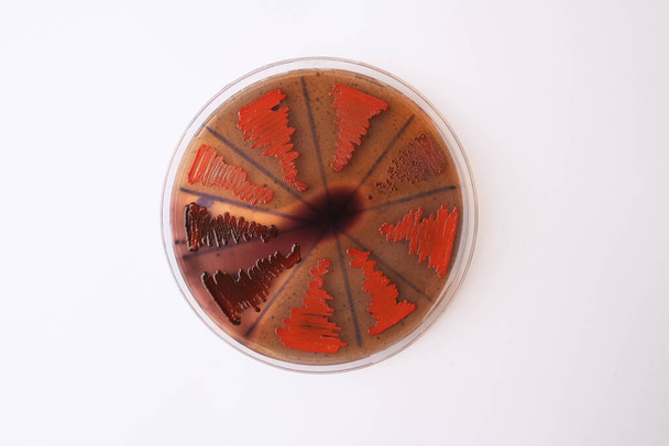κοντινή φωτογραφία βακτηριακών αποικιών που καλλιεργούνται σε μέσα άγαρ - Φωτογραφία, εικόνα
