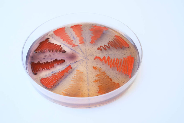 κοντινή φωτογραφία βακτηριακών αποικιών που καλλιεργούνται σε μέσα άγαρ - Φωτογραφία, εικόνα