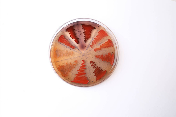 Nahaufnahme von Bakterienkolonien, die auf Agar-Medien gezüchtet wurden - Foto, Bild