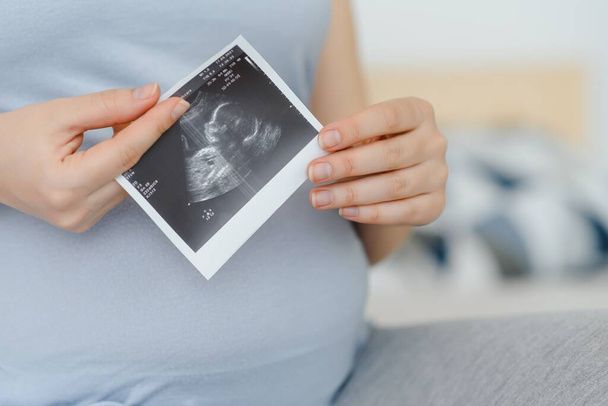 pregnant woman holding ultrasound scan on her belly - Fotó, kép