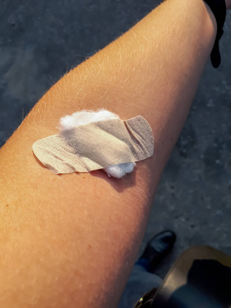 Vista del brazo de la persona con vendaje marrón y bola de algodón debajo de él después de extraer sangre de una vena para un análisis de sangre. Análisis de sangre - Foto, imagen