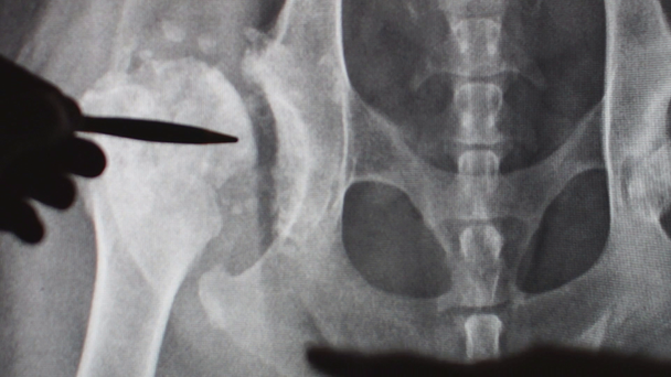 veterinární lékař vysvětlovat pet vlastník rentgenového snímku - Záběry, video
