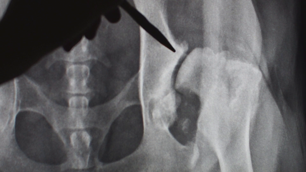 veterinární lékař vysvětlovat pet vlastník rentgenového snímku - Záběry, video