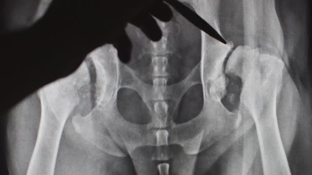 Veterinarian explaining radiograph to a pet owner - Footage, Video