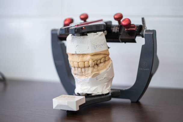 Close-up op een tandheelkundig model met tanden op de achtergrond, close-up - Foto, afbeelding