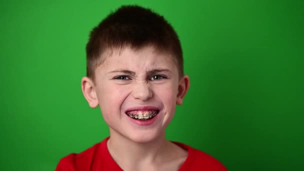 El chico sonríe, alinea sus dientes con una placa dental, cuidado dental. - Metraje, vídeo