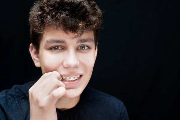 A guy on a black background wears a special elastic band on his braces mounted on his teeth. Dental concept - Photo, Image
