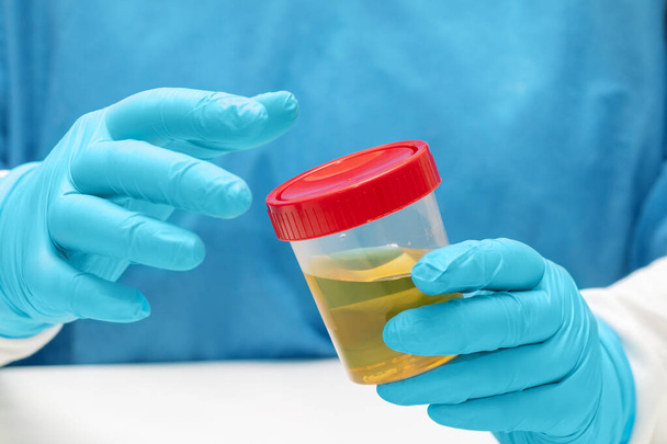 Arzt, Laborantin hält ein Gefäß mit einer Urinprobe, Analyse - Foto, Bild