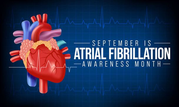 Der Awareness Month National Atrial Fibrillation (AFIB) wird jedes Jahr im September beobachtet. Dabei handelt es sich um eine Herzerkrankung, die eine unregelmäßige und oft ungewöhnlich schnelle Herzfrequenz verursacht. Vektorillustration - Vektor, Bild
