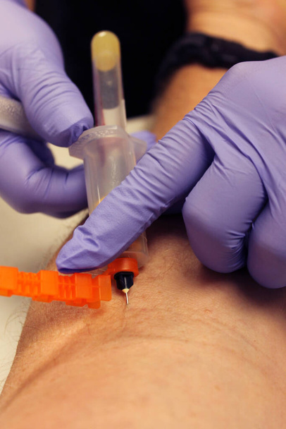 Αίμα. Νοσοκόμα αντλεί ένα δείγμα αίματος για μια ιατρική εξέταση. Ο ασθενής παίρνει αίμα. Ο φλεβοτομιστής παίρνει αίμα ασθενών. Γιατρός αντλεί δείγμα αίματος από το χέρι. Phlebotomist αντλώντας αίμα για τον έλεγχο της νόσου του Coronavirus COVID-19.  - Φωτογραφία, εικόνα