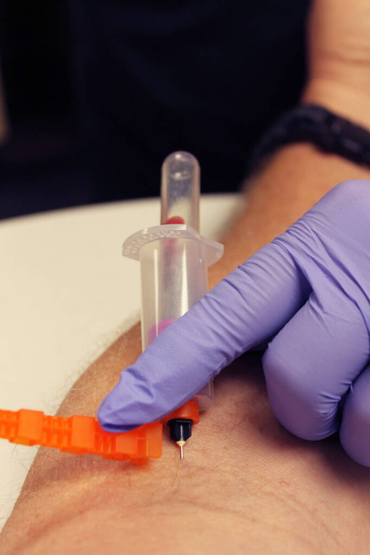 Kan alın. Phlebotomist kan testi için hastanın kanını alır. Doktor kan testi için koldan kan örneği alıyor. Phlebotomist teknisyen Coronavirus 'u test etmek için kan alıyor. COVID-19 salgını. Sağlık ve İlaç kavramı.  - Fotoğraf, Görsel