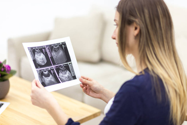 3d illustration of pregnant woman holding ultrasound report at home. - Fotoğraf, Görsel