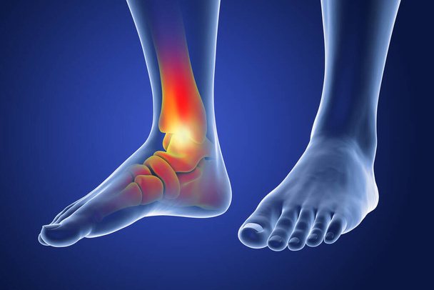 足と足首の痛み、概念的な3Dイラスト。足の解剖学。アキレス腱痛 - 写真・画像