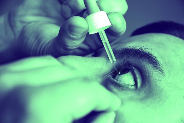 Ο άνθρωπος βάζει σταγόνες στα μάτια του. Ιατροθεραπεία. Αλλεργικό πρόβλημα επιπεφυκίτιδας. - Φωτογραφία, εικόνα