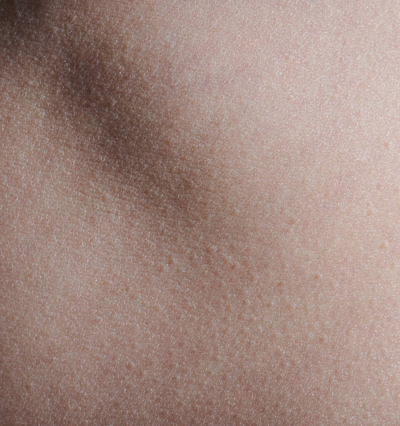 Manchado textura de la piel humana macro vista de cerca - Foto, Imagen