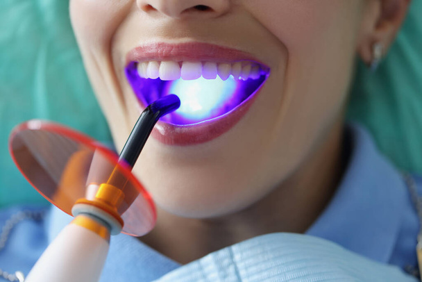 Dentist doctor fills patient teeth with curing light closeup - Фото, зображення