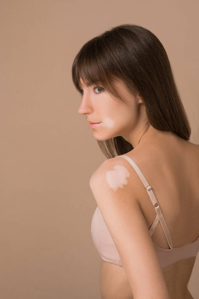 Una mujer joven de pelo bastante largo con pigmentación de la piel mirando a un lado - Foto, imagen