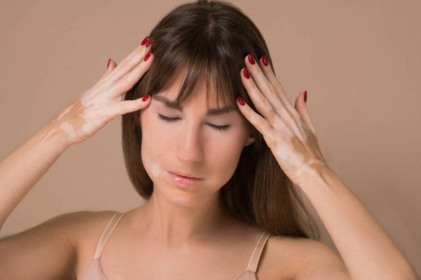 Uma jovem mulher de cabelos longos com pigmentação da pele que sofre de uma dor de cabeça - Foto, Imagem