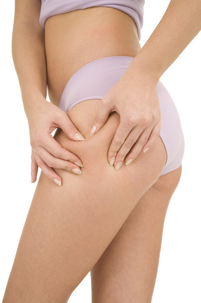 Woman controls the cellulite on the thighs - Φωτογραφία, εικόνα
