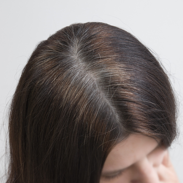 De cerca hay fragmentos de pelo gris en la cabeza de una mujer joven. Concepto de pelo gris temprano. Color y estructura del cabello gris - Foto, Imagen