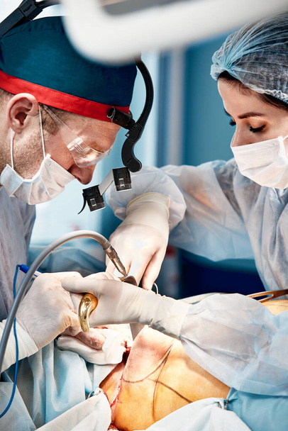 Mamoplastia, médicos de cerca durante la cirugía plástica reconstructiva en las glándulas mamarias femeninas, ocología de la mama femenina - Foto, Imagen