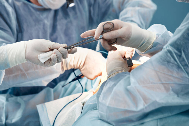 Руки лікарів в рукавичках під час операції, крупним планом операційна медсестра дає затискач хірургу, стирол простір потрібен пацієнту під час операції
. - Фото, зображення