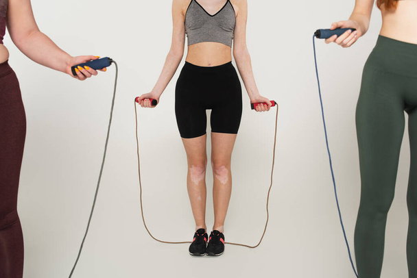 Cropped view of sportswoman with vitiligo holding jump rope near friends on grey background - Zdjęcie, obraz