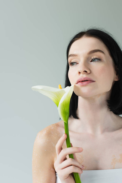 Woman with vitiligo holding calla flower and looking away isolated on grey  - Foto, immagini