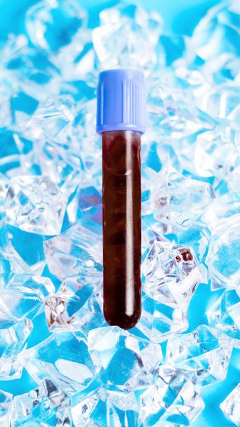Reagenzglas mit Blut im Eis. Bluttest. Biotest. DNA. - Foto, Bild