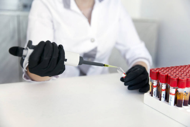 Laborangestellte macht Bluttest mit Röhrchen der Blutprobe für Studie - Foto, Bild