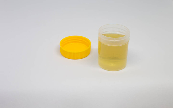 A closeup of a medical container with urine isolated on white background - Foto, Imagem