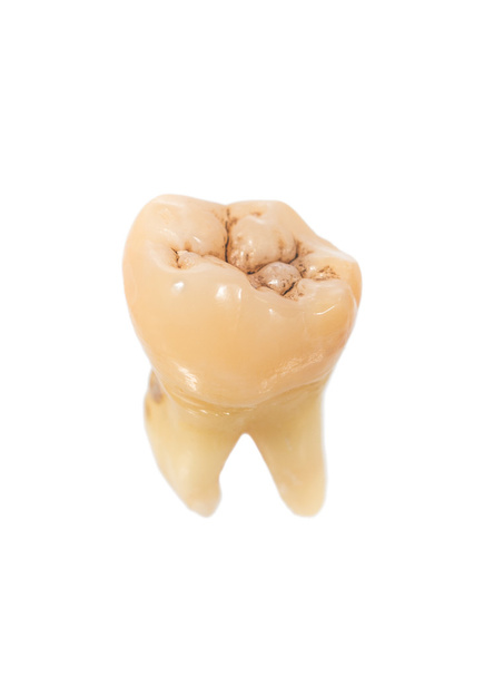 diente humano
 - Foto, Imagen
