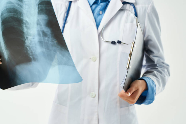 рентгенолог у білому пальто рентген крупним планом
 - Фото, зображення