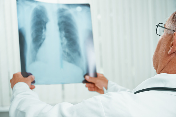 Unrecognizable older doctor examines x-ray image of lungs - Фото, изображение