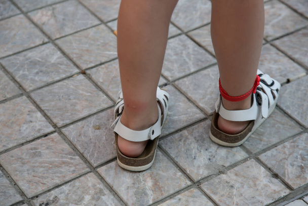 Komáří kousnutí: Hmyzí odpuzující náramek na dětské noze - Fotografie, Obrázek