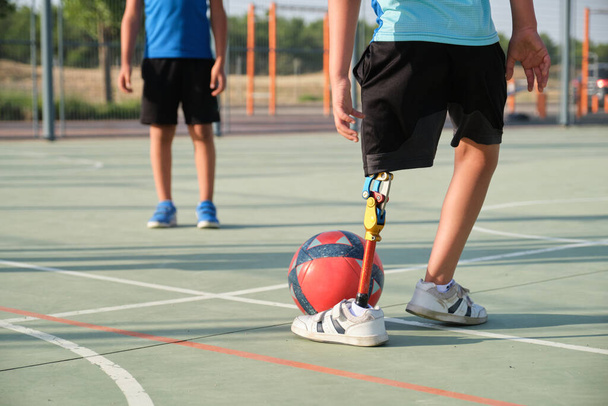 Bambini irriconoscibili che giocano a calcio, uno di loro ha una protesi alle gambe. Fratelli che praticano sport insieme. - Foto, immagini