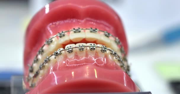 Yapay dişlerdeki diş telleri yakın plan. Diş hekimliği. Diş telleri. - Video, Çekim