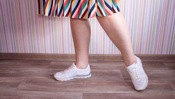 Legs of a woman in a white sneakers and striped skirt. Hair on women's legs - Photo, Image